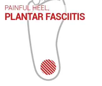 treatment of heel spur and plantar fasciitis