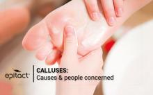 What causes calluses on feet?