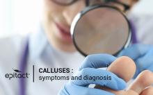 callus symptoms
